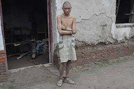 神康扶贫关爱行动:救助曹海涛